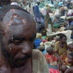 A Hutu refugee with open machete wounds on his head stands amidst a group of hundreds of fellow refugees who were surrounded by the Tutsi Army Thursday April 27, 1995, in the school compound of Kibeho, southern Rwanda. At least 2,000 people were killed by army gunfire or trampled in a stampede the previous week while the Rwandan army was trying to close the camp, which the government considered a center for extremist Hutu militias. (AP Photo/Jean-Marc Bouju)